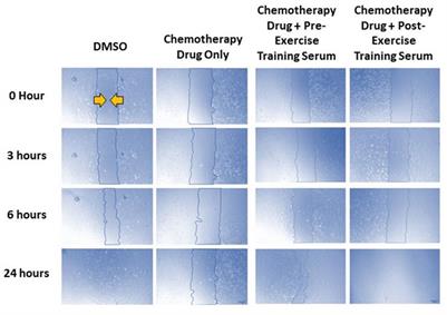 Ex Vivo treatment of coronary artery endothelial cells with serum post-exercise training offers limited protection against in vitro exposure to FEC-T chemotherapy